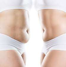 Soin bien-être Séance enveloppement Cryo Ventre /Bras